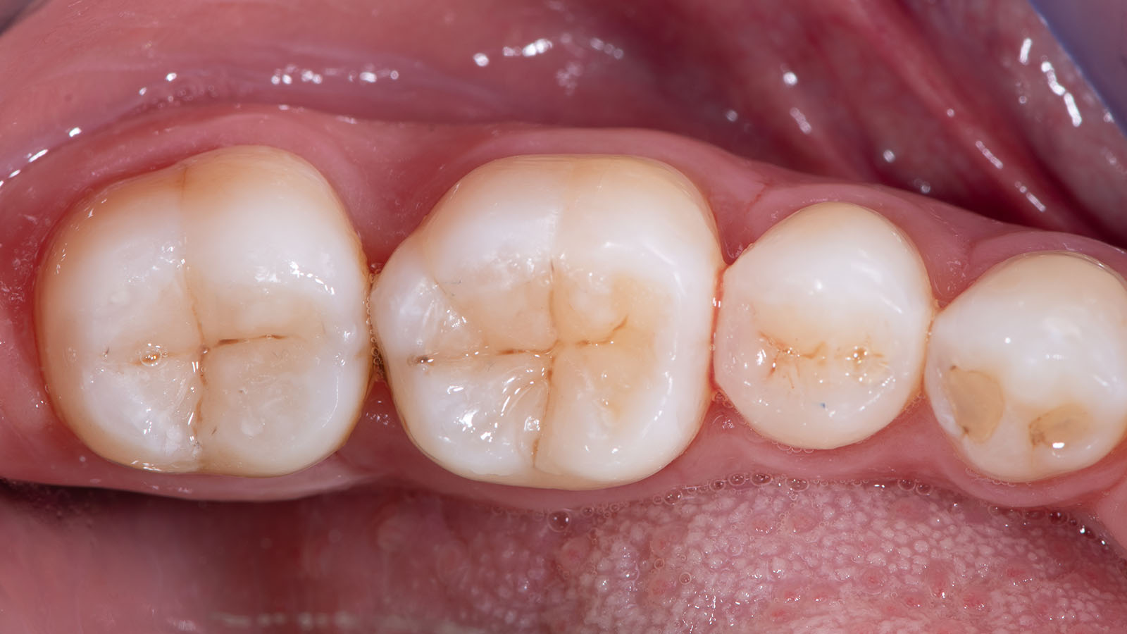 Dentisteria